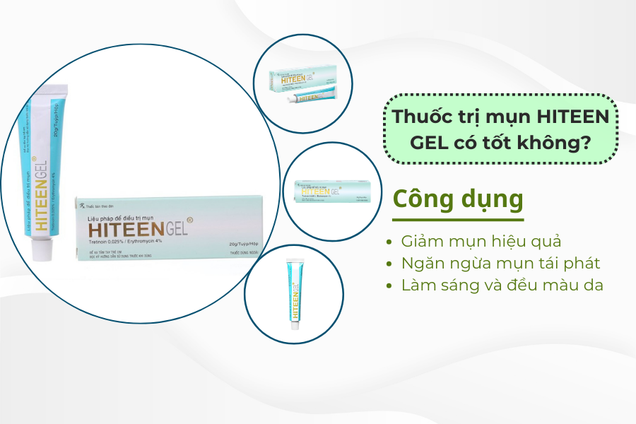 thuốc trị mụn hiteen gel có tốt không